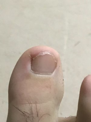ワイの足の爪見てくれ