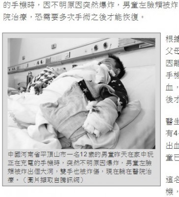 【中国】充電中のスマホが爆発し少年の頬の肉が吹き飛ぶ 中国